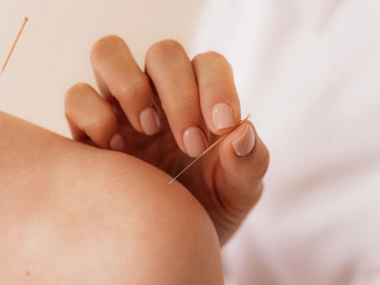 Dry needling für Triggerpunkte und Muskelverspannungen