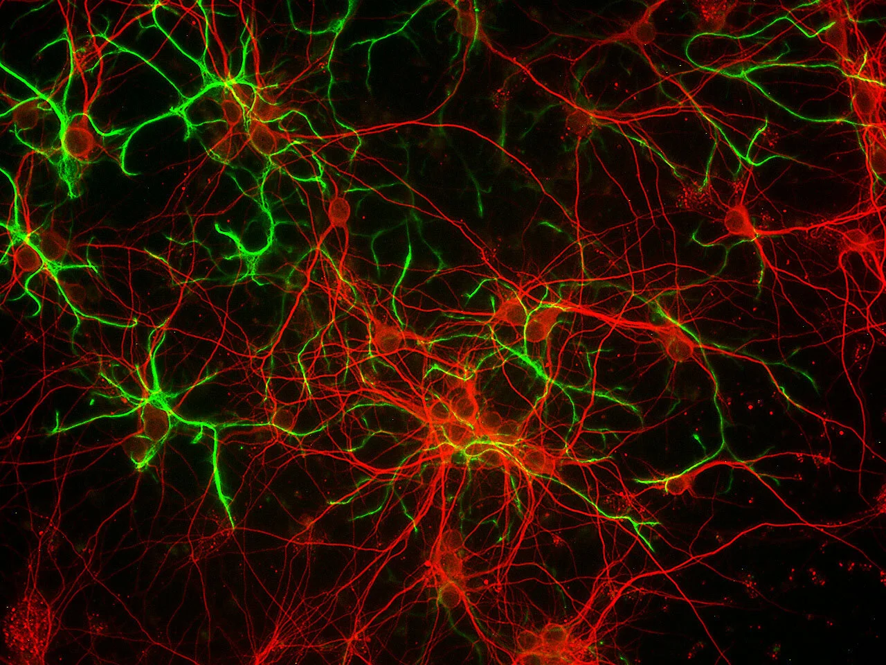 Cortex Cels Mouse CD Cerebral Cortex — QBM Cell Science