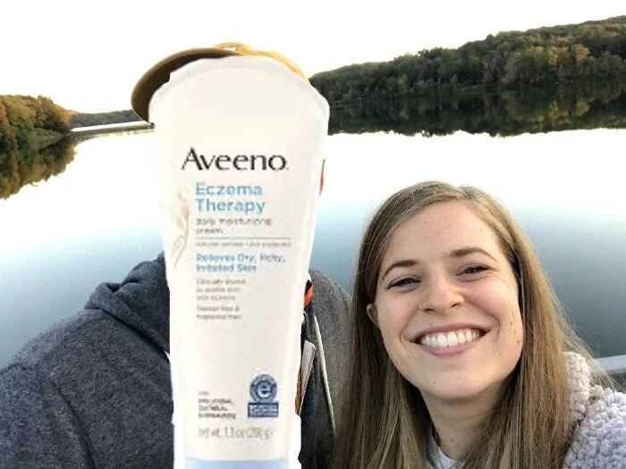 The Complete Timeline of My Relationship With The Eczema On My Hands