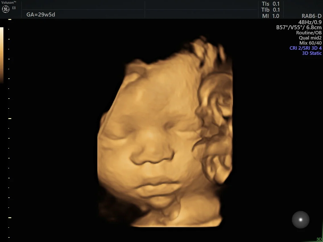 Pregnancy Scans — Galway Ultrasound Specialists