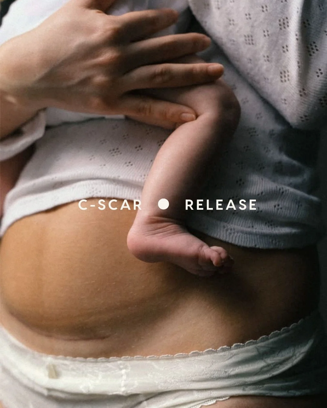 A caesarean is major abdominal surgery, yet so often the scar is left to heal on its own. Over time, that tissue can become tight, numb, or stuck to the layers beneath, pulling on the pelvis, lower back, and core long after the wound has closed.

Gen