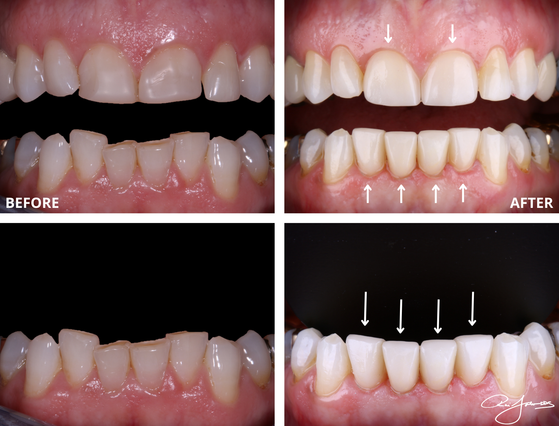 4 PHOTO BEFORE  AFTER.png