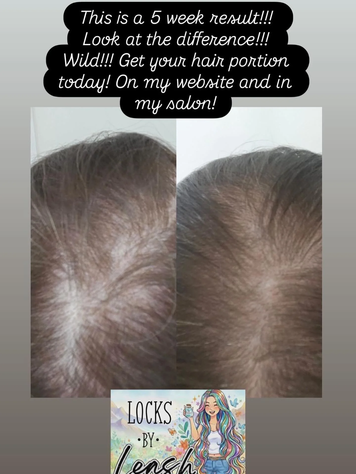 How amazing is this???? Only after 5 weeks!!!
#get your Locks by Leash potion today! On my website and in shop! And I do ship!
#locksbyleashpotion#hairloss#hairgrowth
