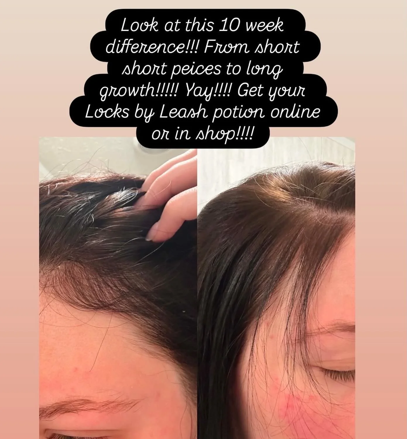 Locks by Leash potion! Amazing results with consistent use!!! Grab yours online hairbyleash.com or in shop!
#hairlosspotion#hairlosssolution#hairthinningsolution