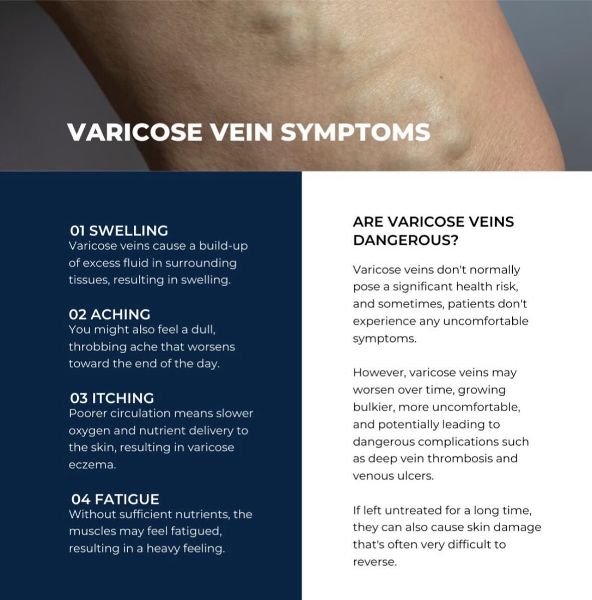 Experiencing:✨
✅ Bulging veins?
✅ Aching legs?
✅ Fatigue or heaviness?

Varicose veins can cause discomfort and affect your confidence.

At The Vein Institute, we offer minimally invasive treatments to alleviate symptoms and restore healthy leg appea