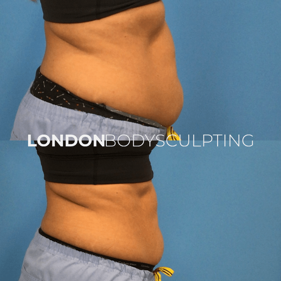 Elite-Abdomen_3.3.PNG