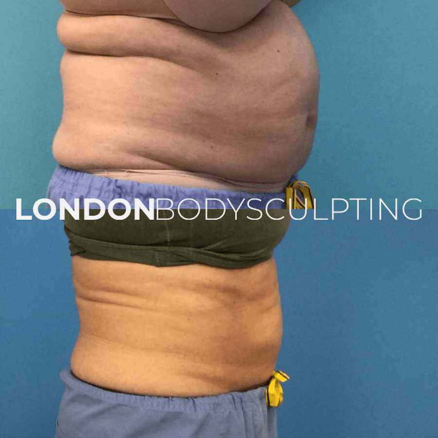 Elite-Abdomen_8.4.PNG