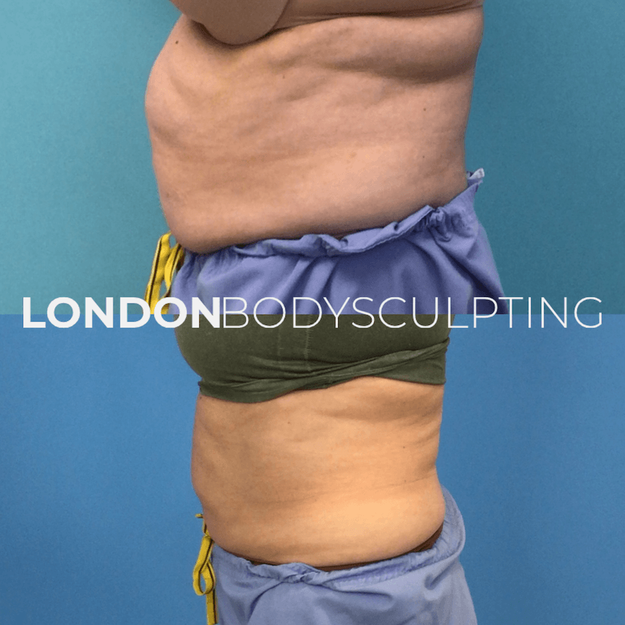Elite-Abdomen_8.3.PNG