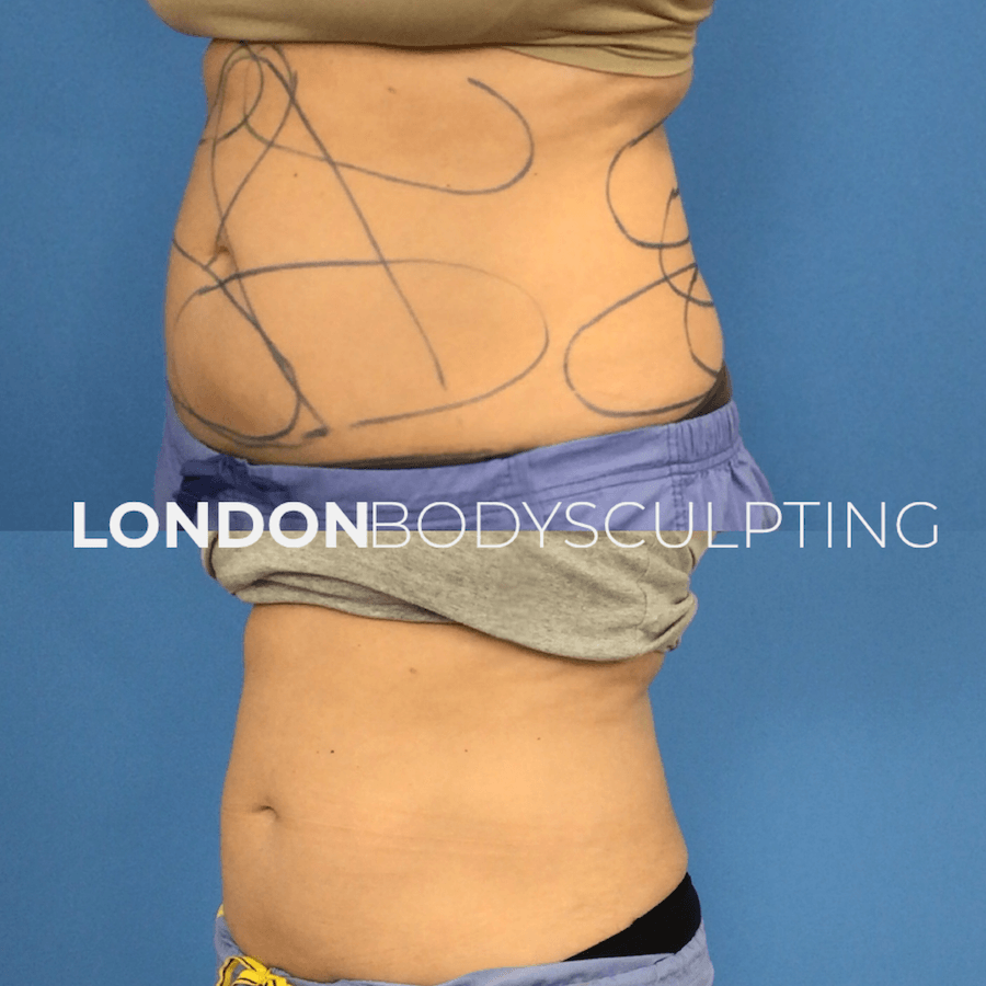 Elite-Abdomen_10.1.PNG