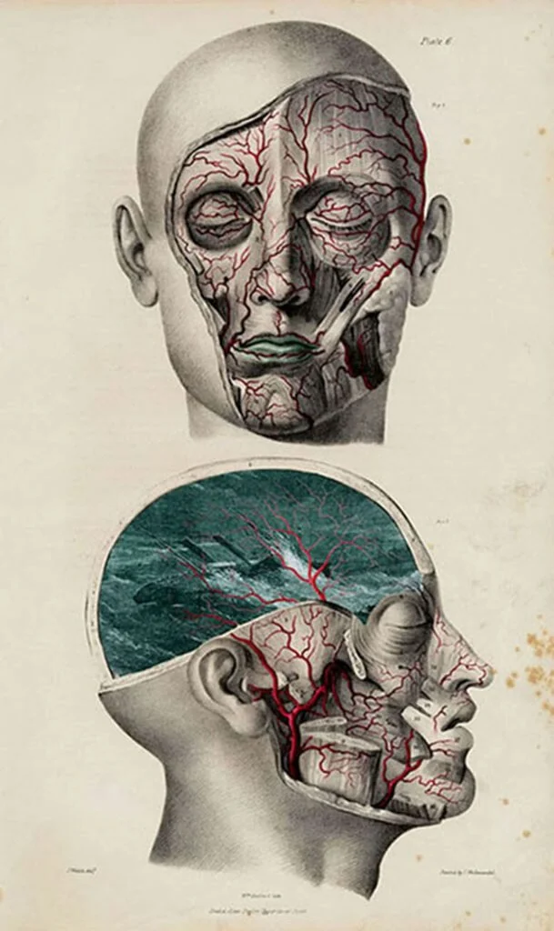 The Disaster Series