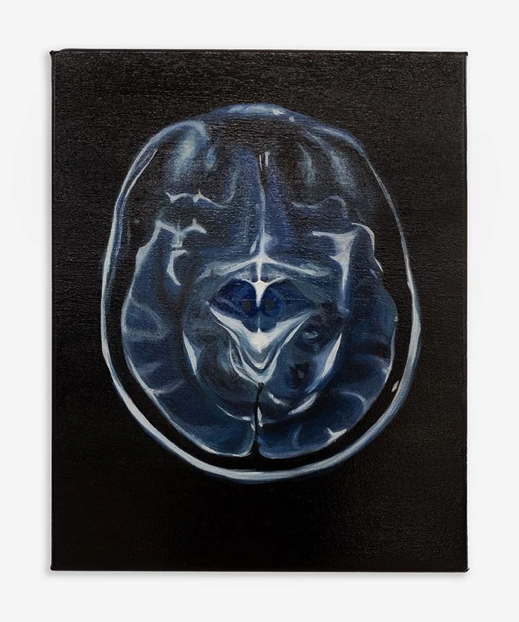   MRI , 2021 Oil on linen 36 x 28 cm (14 x 11 in)  Using the latest advances in cognitive psychology and brain science, we can gain a deeper understanding of the complexity and power of the human brain. It allows us to learn, see, remember, hear, per