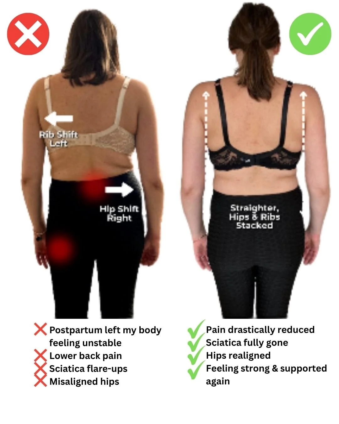 Comparison of a woman's back before and after a fitness transformation. The left side shows misaligned hips, postpartum instability, and sciatic flare-ups, with labels pointing out rib shift left and hip shift right. The right side shows the same woman with a straighter back, stacked hips, and improved posture, with positive health labels.