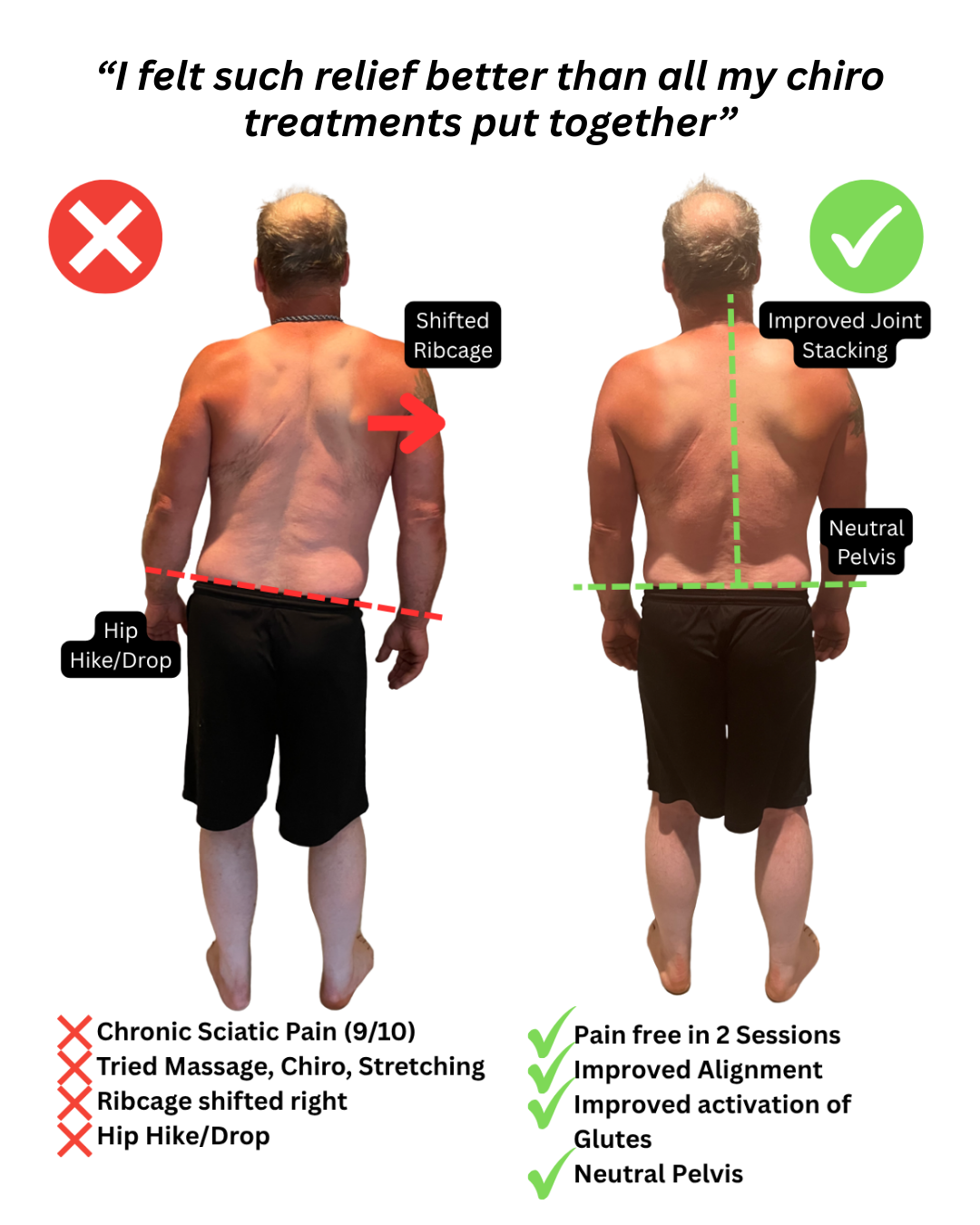 Comparison of a man's back before and after treatment showing improved posture and alignment. The left side indicates issues like shifted ribcage, hip hike/drop, and chronic sciatic pain. The right side shows improvements with aligned joints, neutral