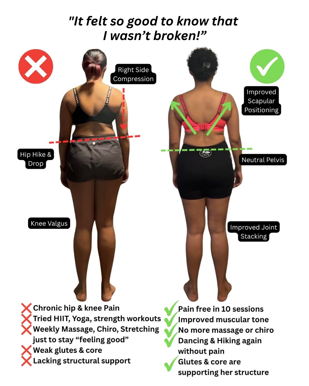 Comparison of a woman's back before and after a fitness transformation, with labels highlighting improved scapular positioning, neutral pelvis, and other benefits, and previous issues like chronic hip and knee pain, weak glutes, and lack of structura