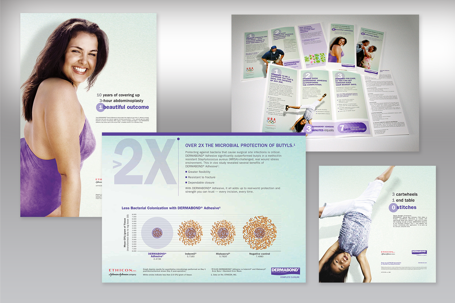 Dermabond inside.png