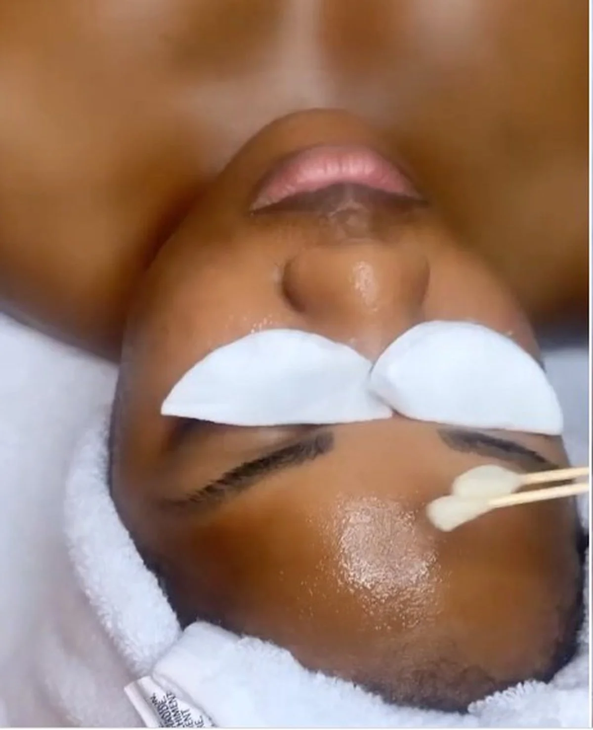 Customized Peel