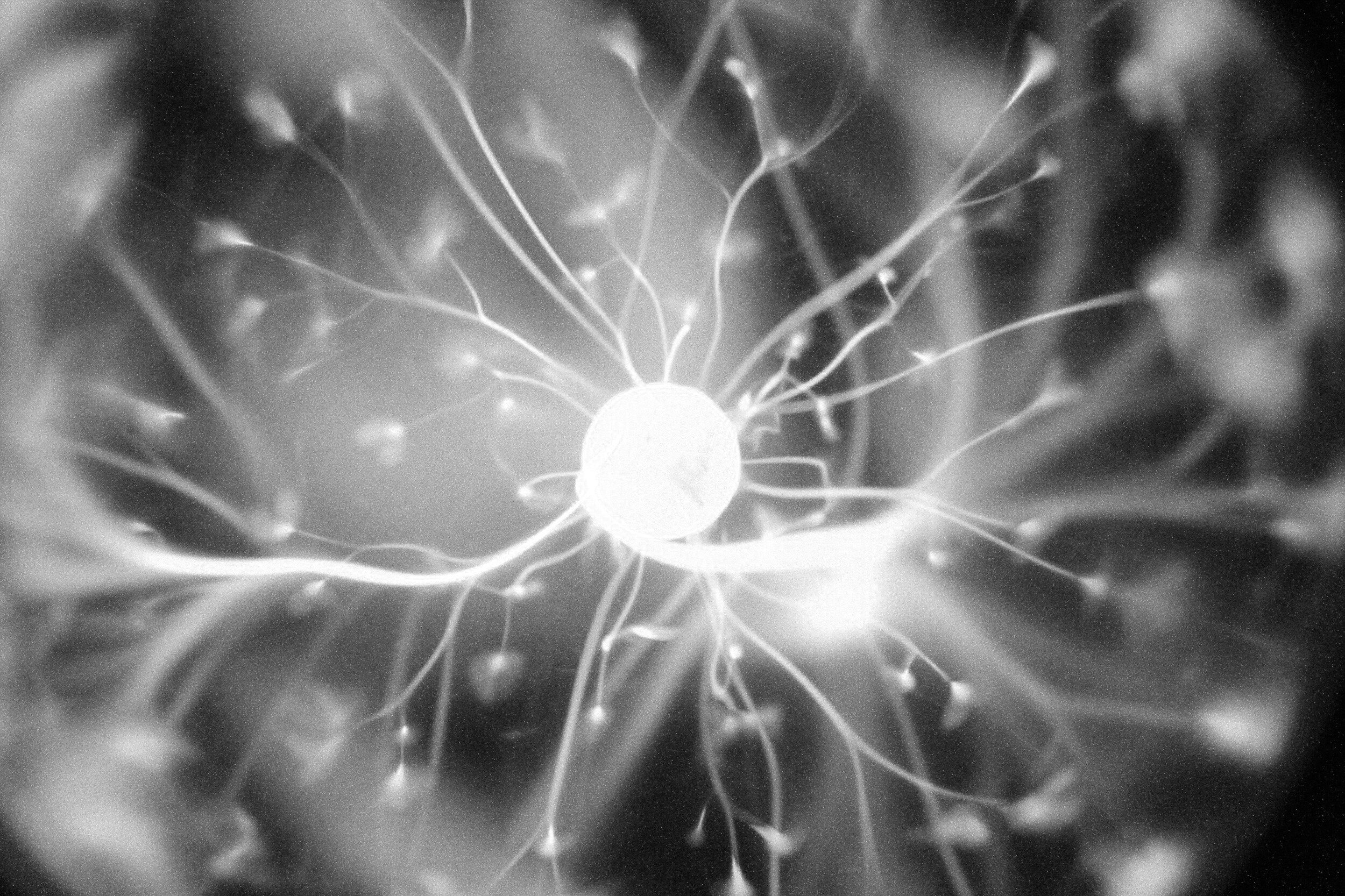 Developments in Type Theory: Analytic vs Holistic Brain Wiring