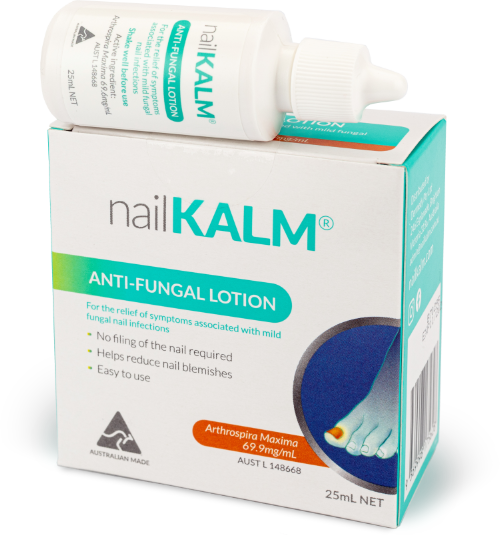 A box of NailKALM anti-fungal lotion with a 25mL bottle placed on top.
