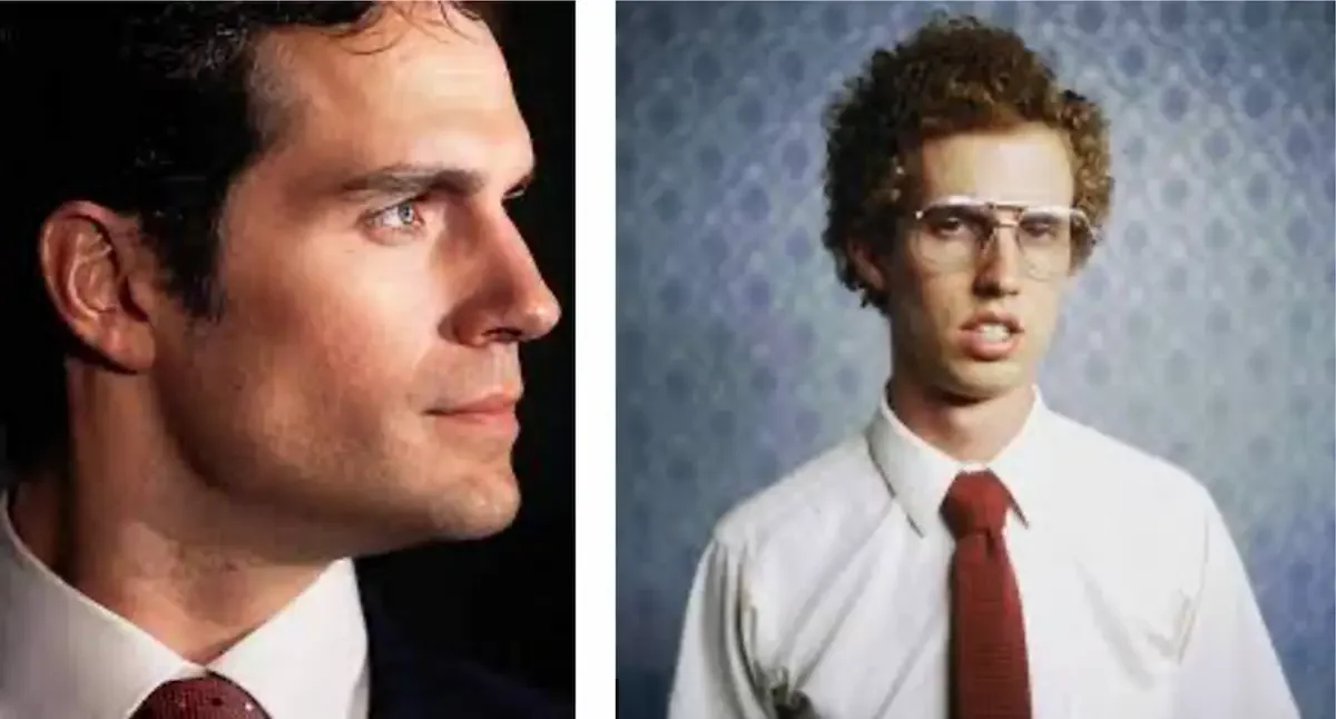 Nasal Breathing jaw vs Mouth breathing jaw development