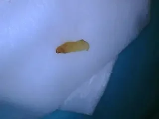 Popcorn Kernel that was causing gum irritation