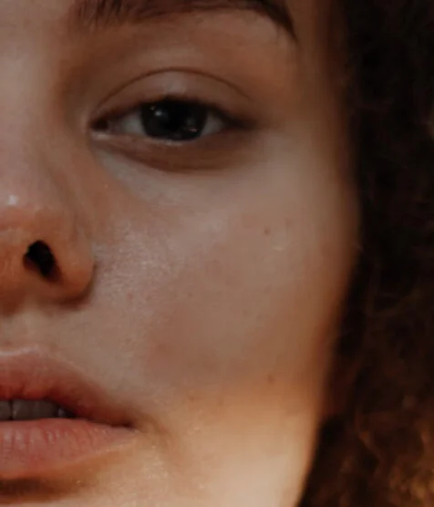 How Many Units of Botox Do I Need?