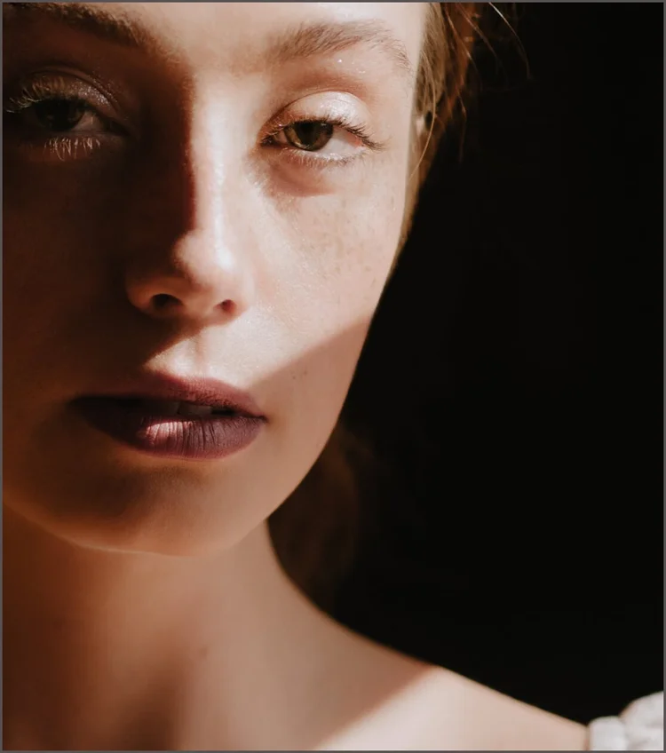 BBL Photofacial in Bethesda, MD