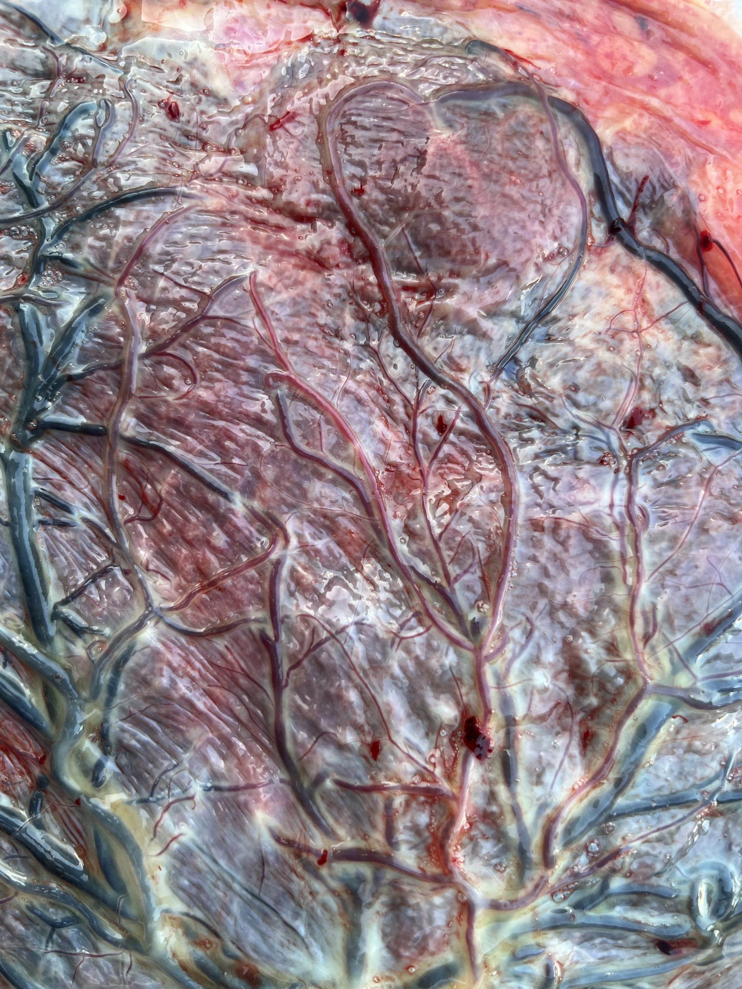 placenta zoom.jpg