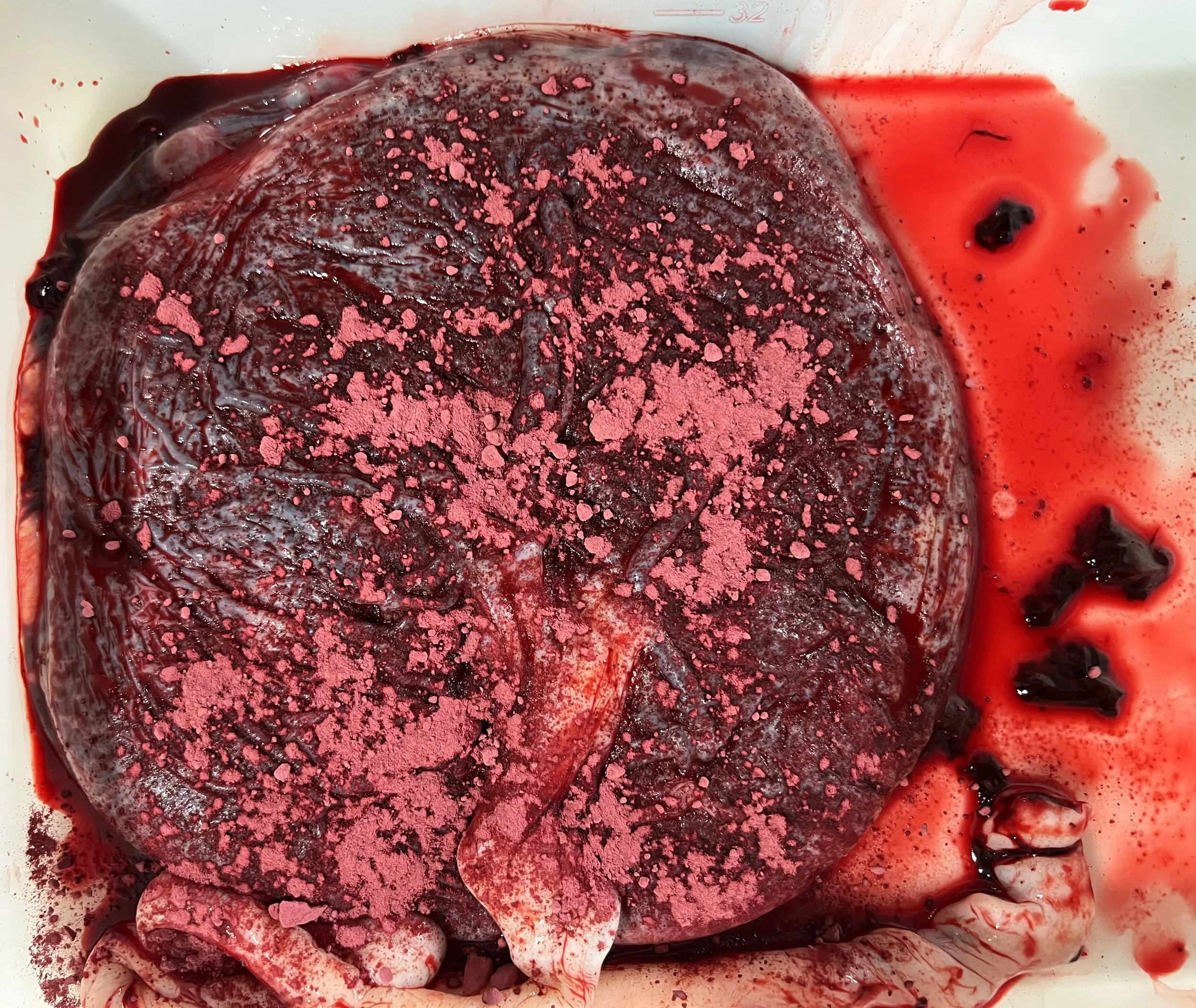 placenta love.jpg