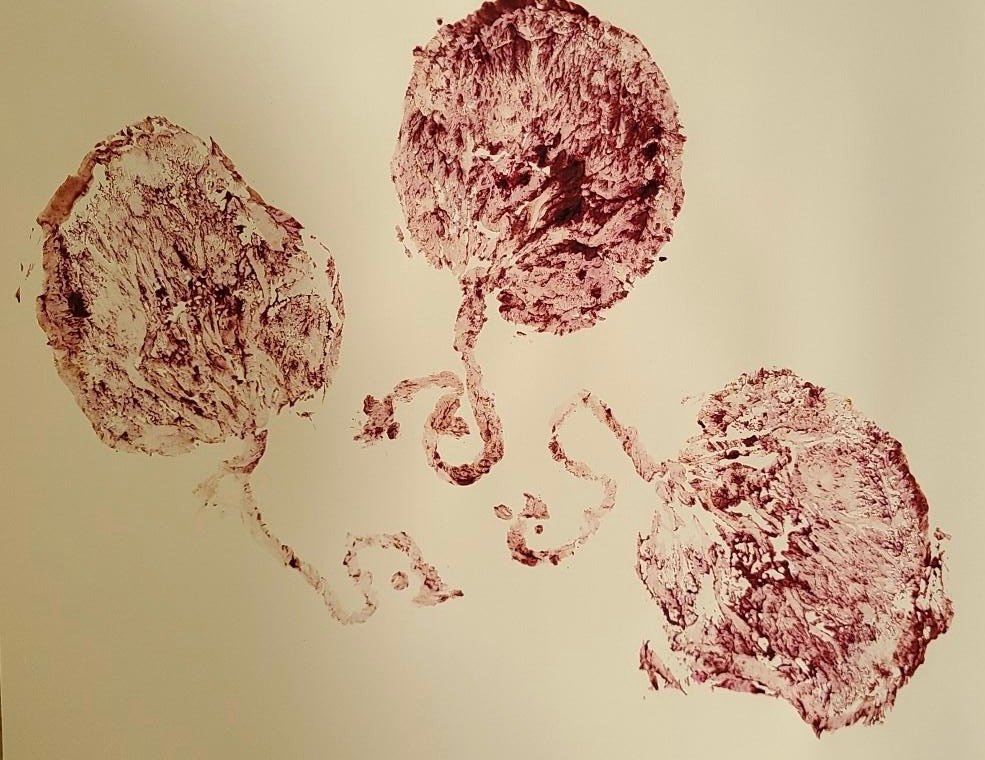 placenta print 4.jpg