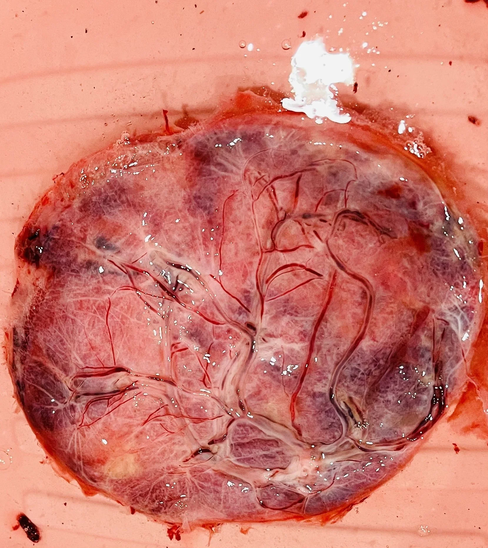 placenta love 2.jpg