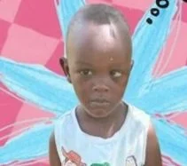 Emmanuel Mutugi before surgery