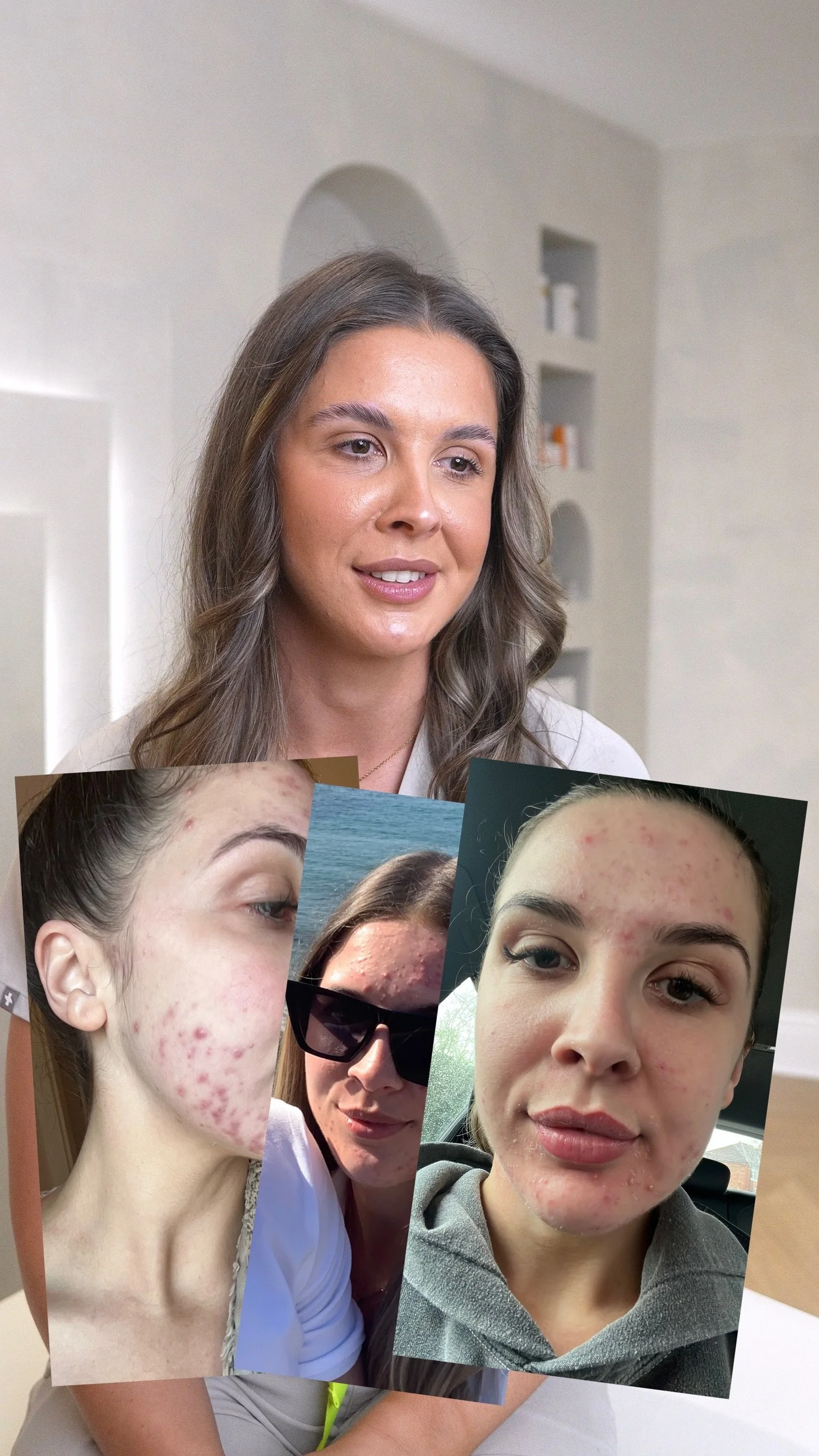 From Struggle to Confidence: Molly’s Skin Journey