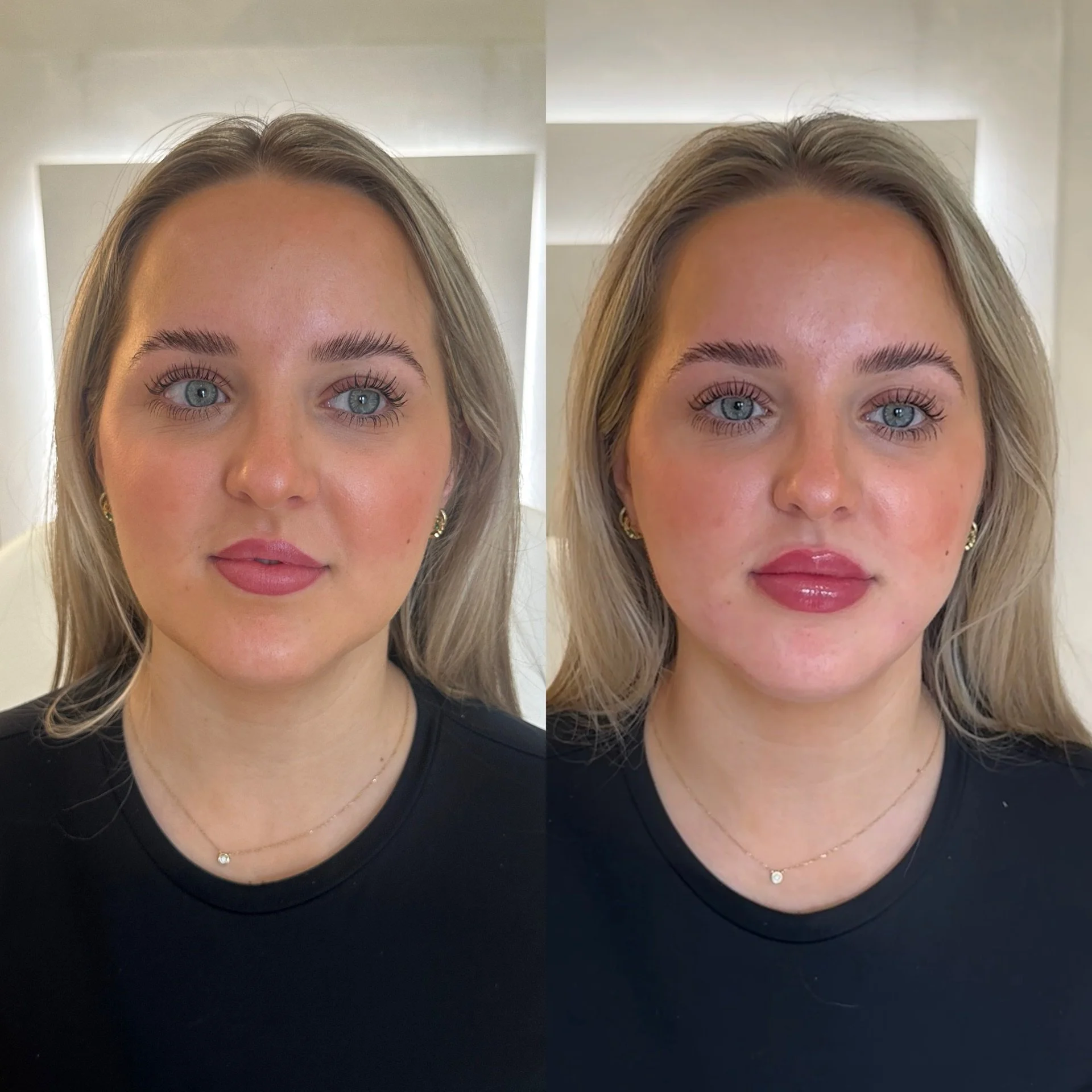 The Power of Subtle: Real Transformations From Our Aesthetic Team