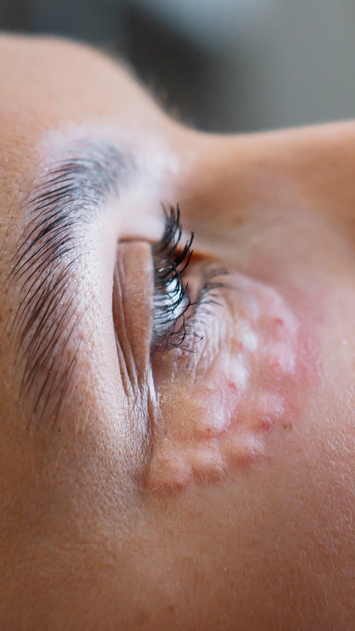 Polynucleotides: The Viral Treatment Explained