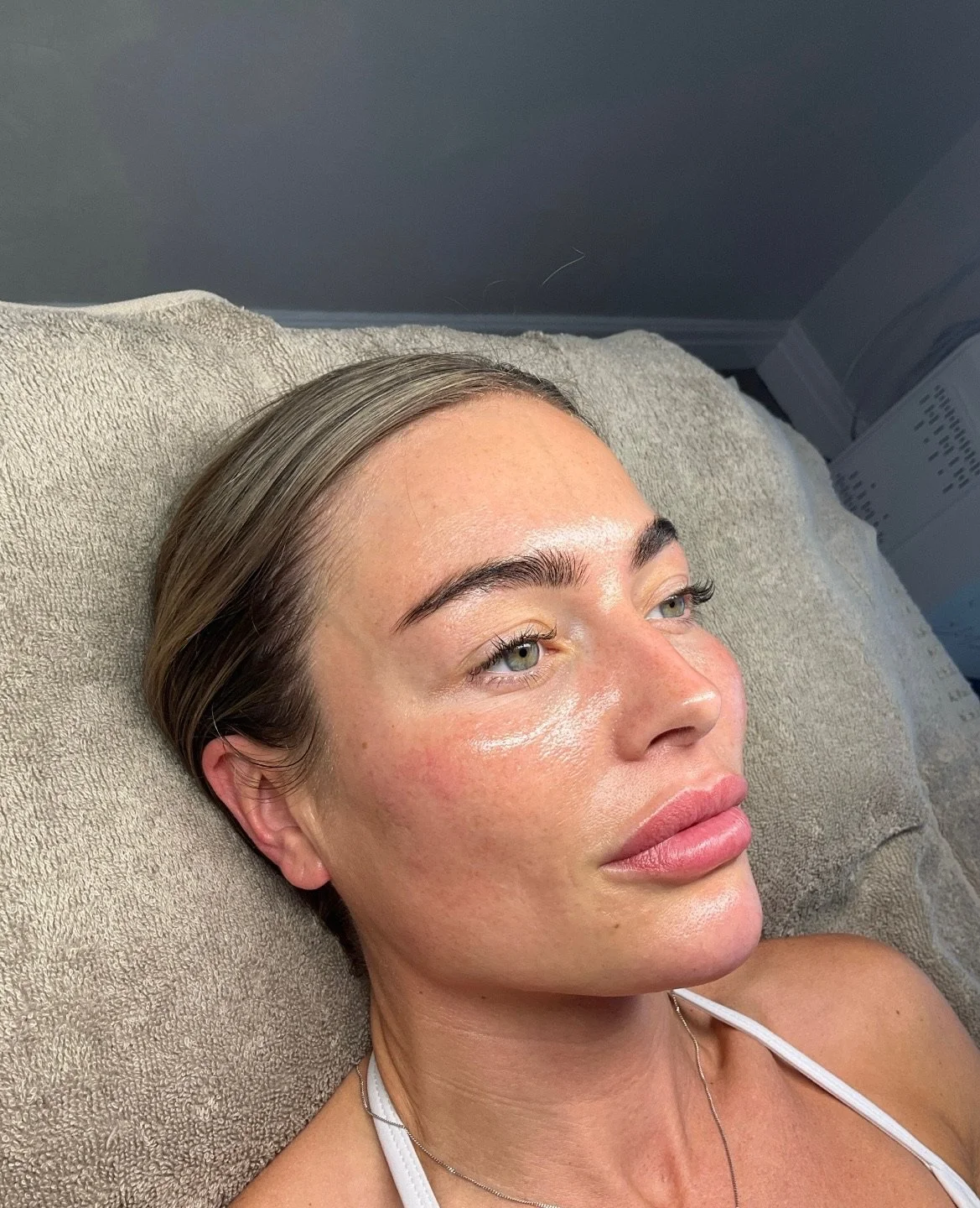 The Post-Sun Skin Hangover (And What to Do About It)