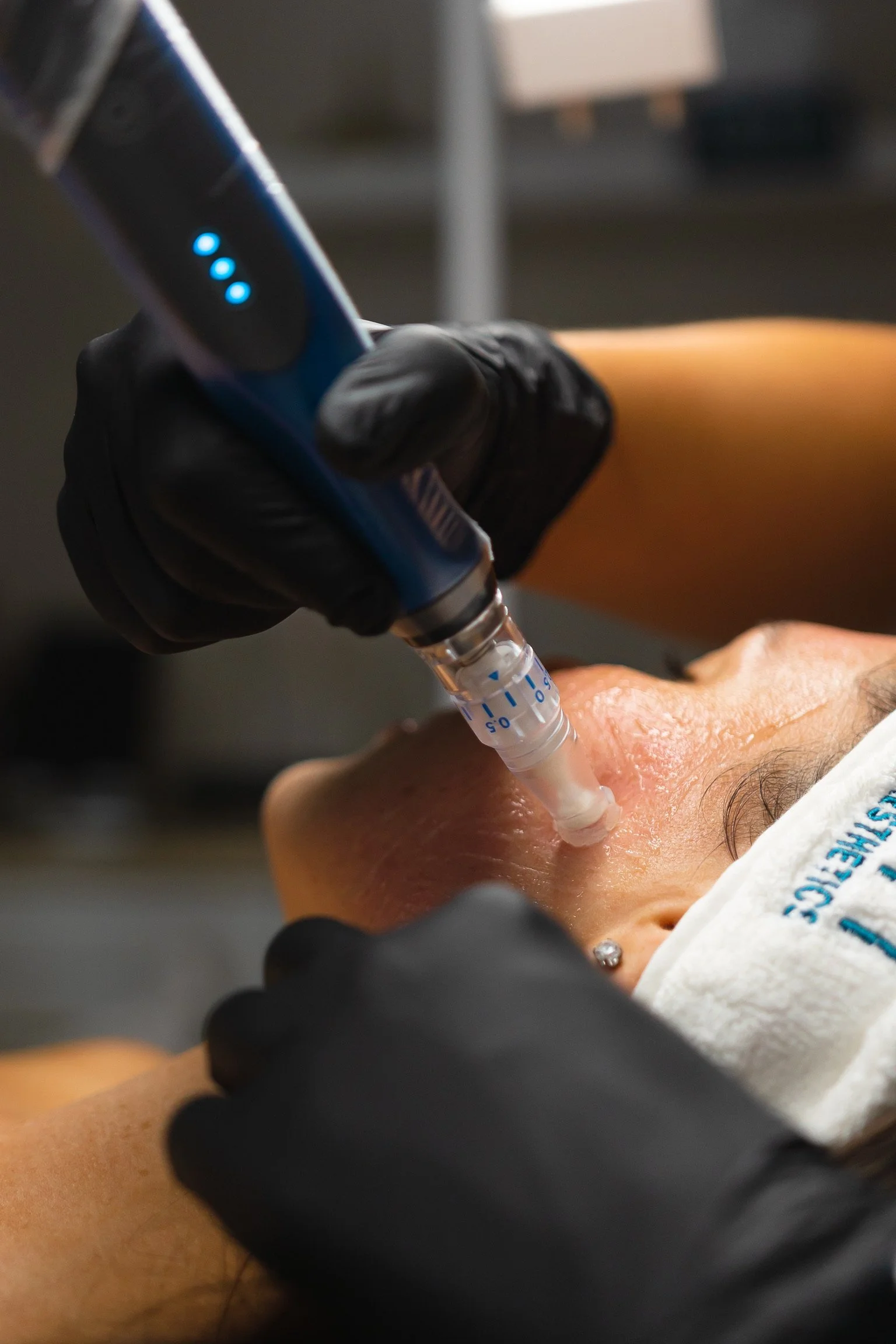 Why Autumn Is the Ideal Time to Start an Advanced Skin Treatment Plan