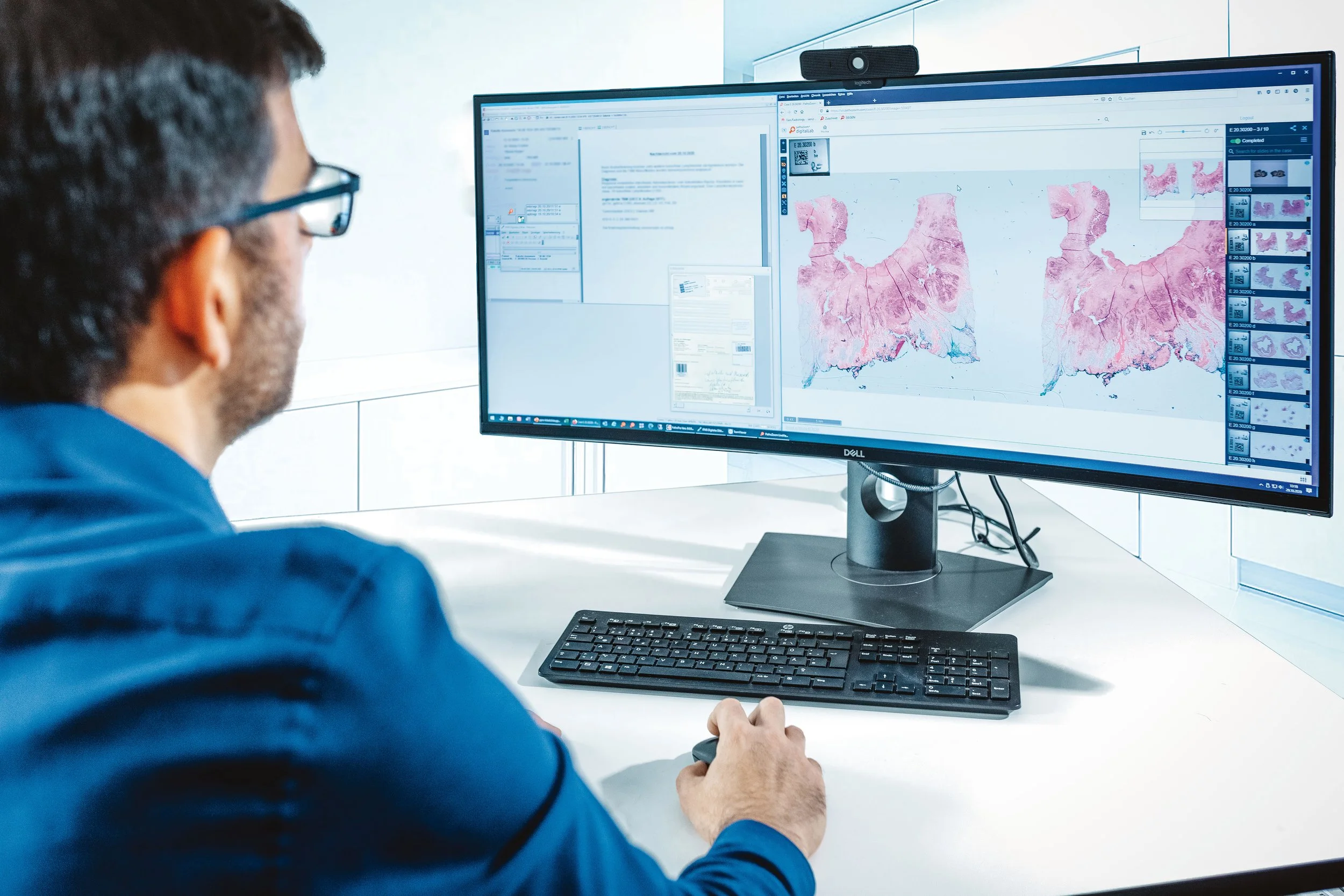 Pathologist looking at digital pathology imiges provided by Smart in Media