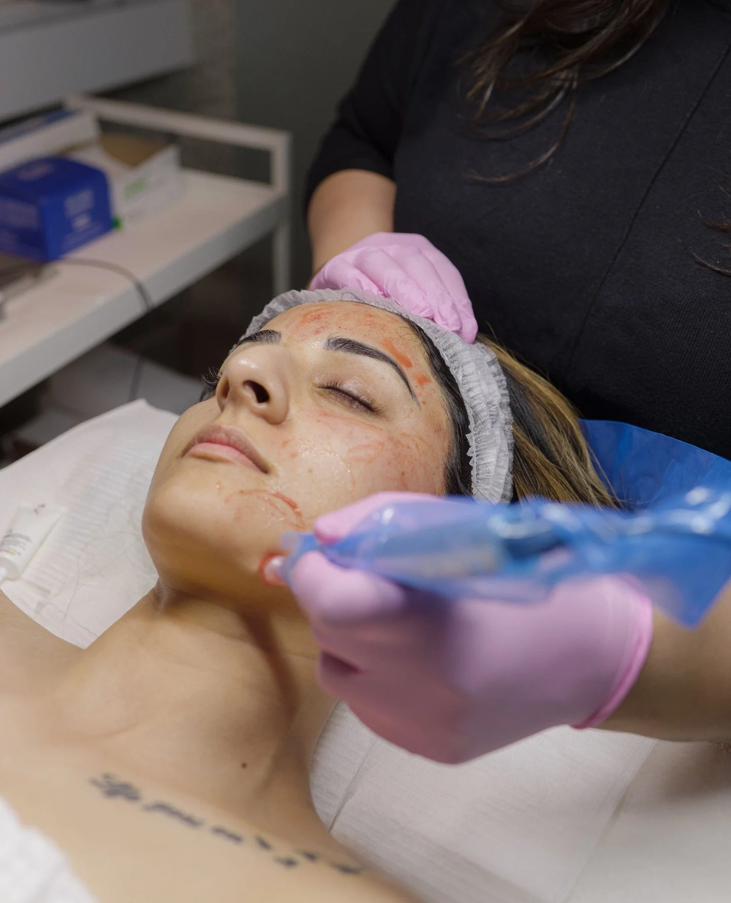 Microneedling is one of the most effective ways to refresh your skin before the holidays but timing matters. ✨⁠
⁠
This minimally invasive treatment stimulates collagen and cell renewal to smooth texture, fade acne scars, even tone, and soften fine li