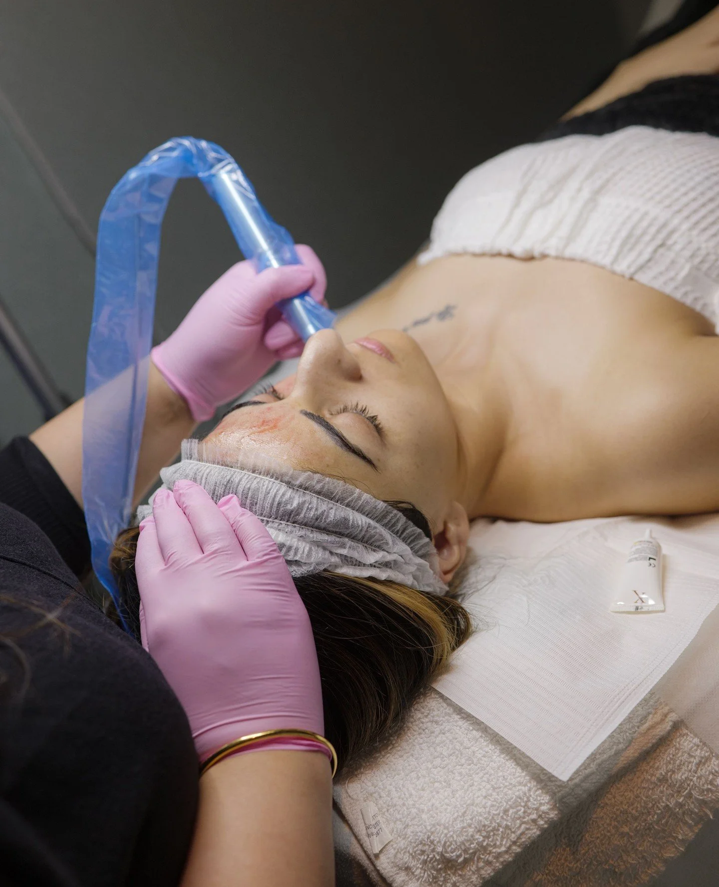Microneedling is one of the most effective ways to smooth, tighten, and refresh your skin and pairing it with PDRN Exosomes (Salmon DNA) takes your results even further.⁠
⁠
This advanced add-on supports deep cellular repair and collagen regeneration,