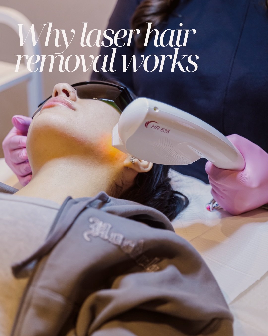 Why laser hair removal actually works ✨

Laser hair removal targets the pigment in your hair. The light converts to heat, which safely damages the hair follicle and slows future growth.

Because hair grows in cycles, only hairs in the active growth p