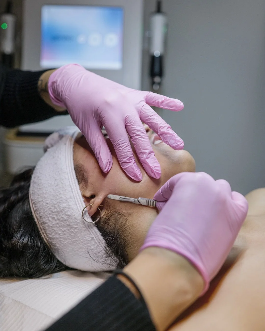 Fresh, smooth, glowing skin - just in time for spring! 🌷

Dermaplaning gently removes dead skin cells + peach fuzz, leaving your skin softer and brighter! Perfect for a seasonal reset or before an event ✨

#yvrbusiness #vancouverbc #medspa #glowings