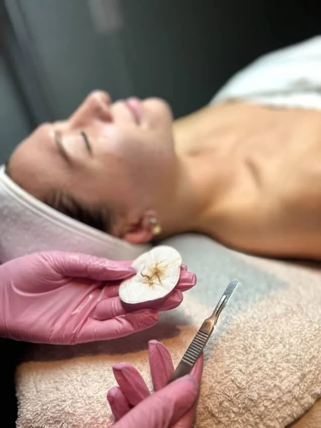 At our clinic, you&rsquo;re always in experienced hands 🤍

Our team is highly trained, knowledgeable, and passionate about skin health and wellness. We stay up to date with the latest treatments, techniques, and education so we can provide results-d