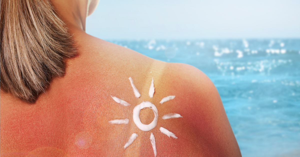 Sun Protection Beyond Sunscreen: Why Built Shade Matters