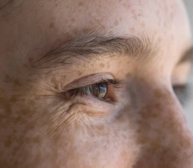 Close-up of a person's eye, showing the eyelid, eyelashes, and surrounding skin with freckles and wrinkles.