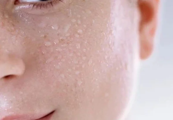 Close-up of a person's face.