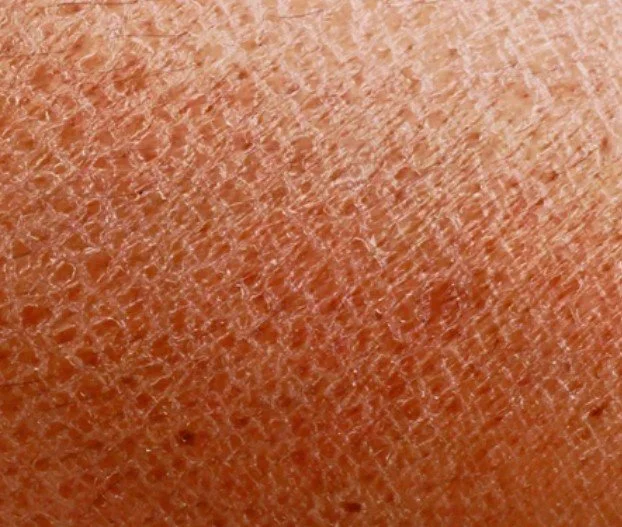 Close-up of human skin showing pores and texture.