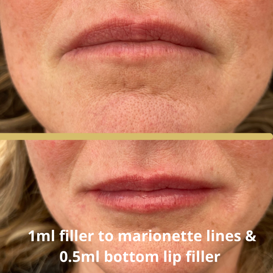 before and after4.PNG