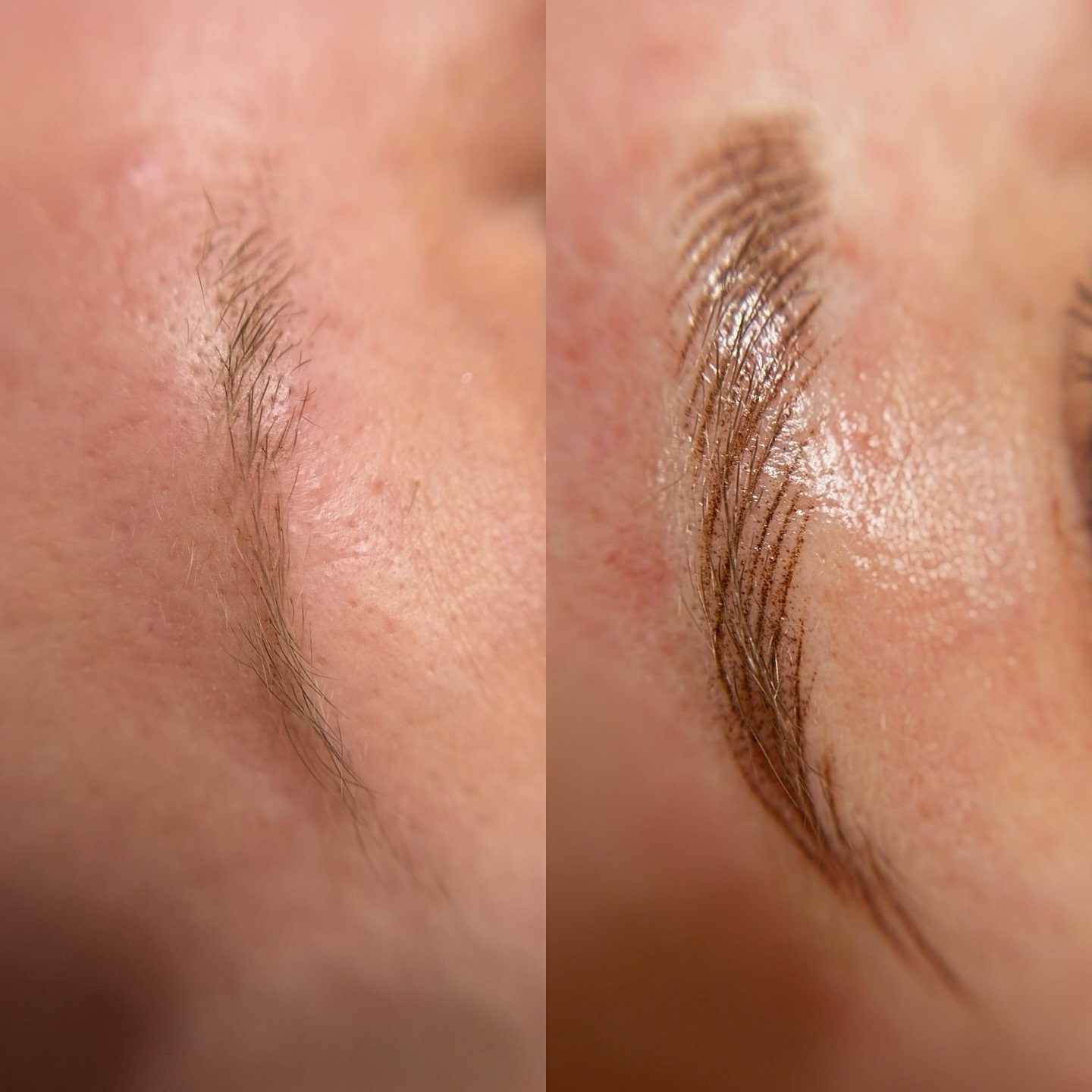 Just building brows from scratch with some georgous nano hair strokes and a smidge of shading to add dimension❤️

www.MotherOfBlades.com 
#permanentcosmetics 
#electrumcleanse 
#hushanesthetic 
#permablendpigments 
#finelinestudiopmu