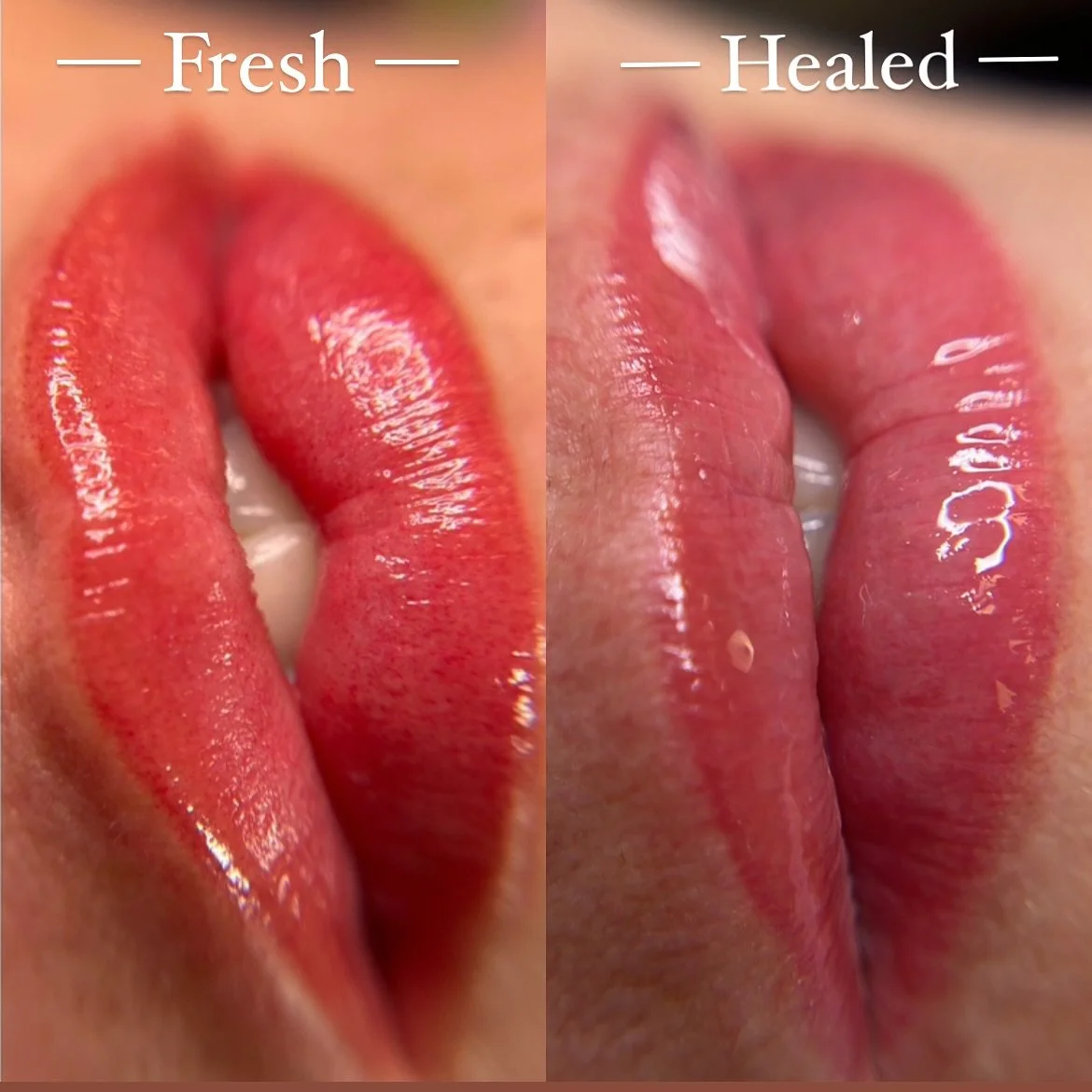 Lip Blush 

💋Treatment time: 2-3 hours 
💋Downtime: 0 
💋Pain: Minimal
💋Requires 2-3 sessions to achieve full results.
💋No harsh outlines 
💋Swelling can occur, and goes down within 48hr.
💋Recommended annual (2-3yr) refresher to maintain color.
?