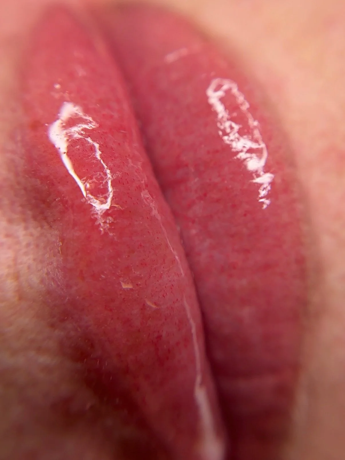 My client came in a few months ago with over lined and over filled lips. We did a consultation that day to discuss her options. While it&rsquo;s hard to have these conversations, it&rsquo;s important to have them. I never want to talk down on another